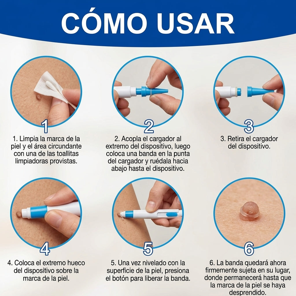 Kit de Eliminación de Verrugas 2 en 1