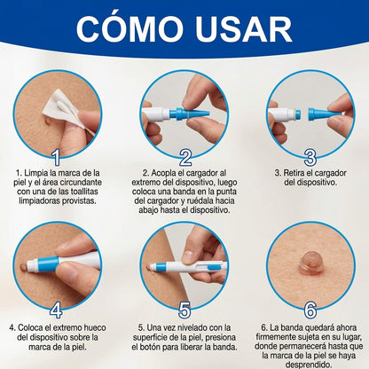Kit de Eliminación de Verrugas 2 en 1